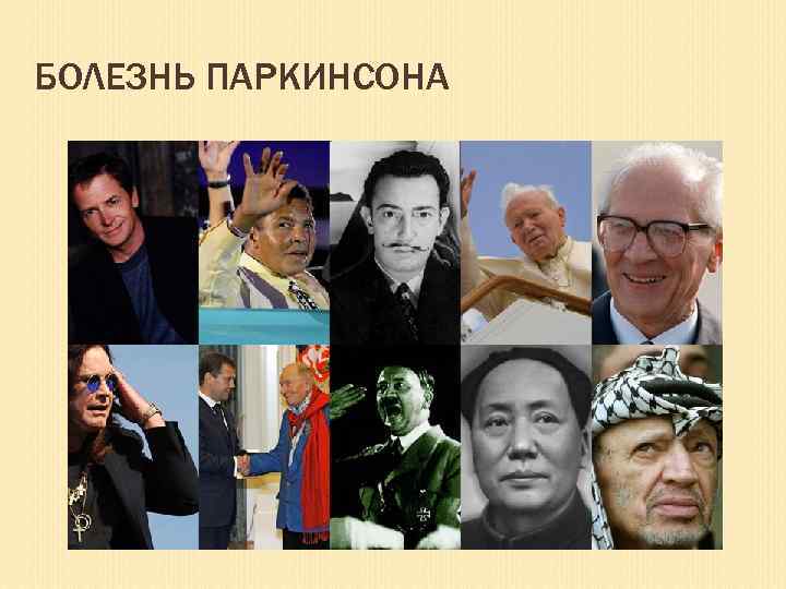 БОЛЕЗНЬ ПАРКИНСОНА 