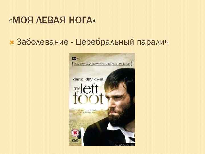 «МОЯ ЛЕВАЯ НОГА» Заболевание - Церебральный паралич 