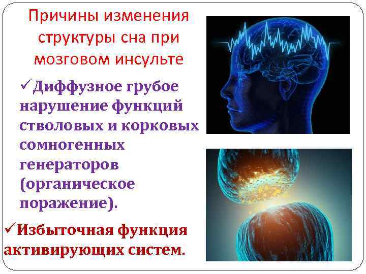 Причины изменения структуры сна при мозговом инсульте üДиффузное грубое нарушение функций стволовых и корковых