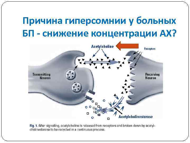 Причина гиперсомнии у больных БП - снижение концентрации АХ? 