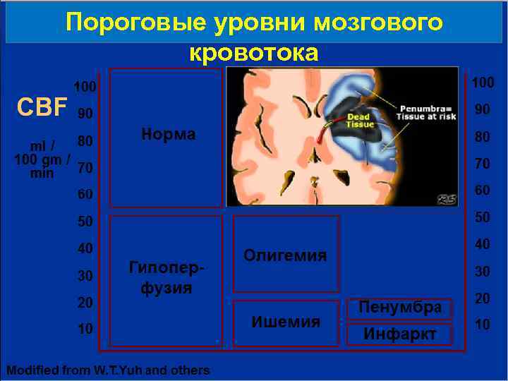 Пороговые уровни мозгового кровотока 
