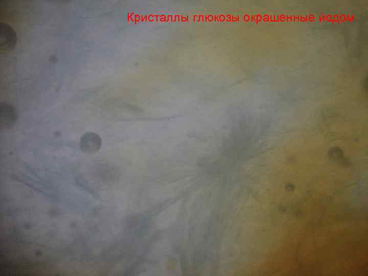 Кристаллы глюкозы окрашенные йодом 