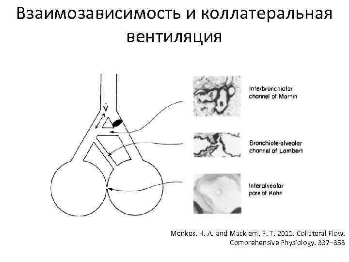 Взаимозависимость и коллатеральная вентиляция Menkes, H. A. and Macklem, P. T. 2011. Collateral Flow.