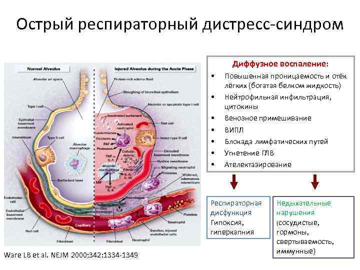 Ордс клинические рекомендации фар