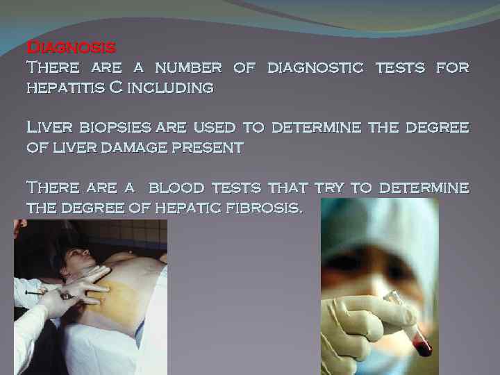 Diagnosis There a number of diagnostic tests for hepatitis C including Liver biopsies are
