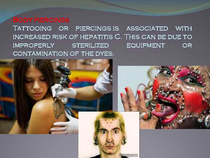 Body piercings Tattooing or piercings is associated with increased risk of hepatitis C. This