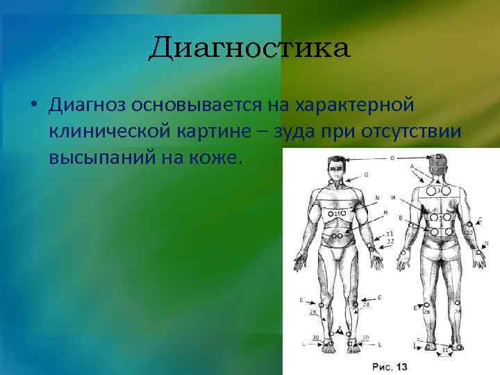Диагностика • Диагноз основывается на характерной клинической картине – зуда при отсутствии высыпаний на