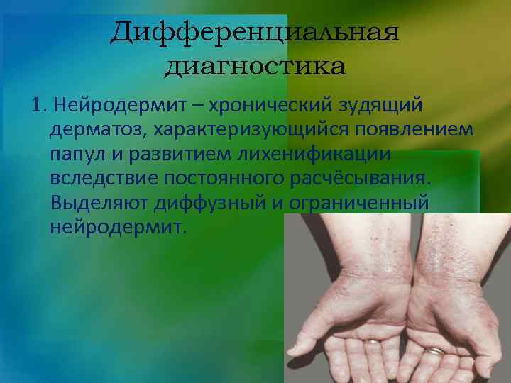 Дифференциальная диагностика 1. Нейродермит – хронический зудящий дерматоз, характеризующийся появлением папул и развитием лихенификации