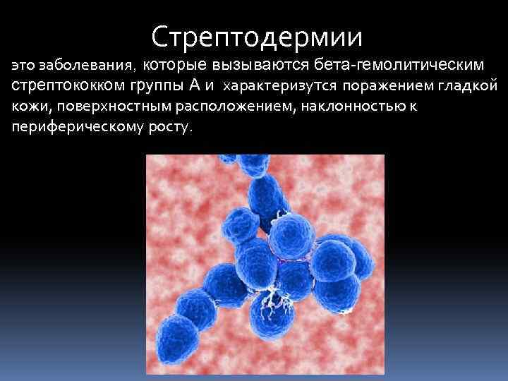 Стрептодермии это заболевания, которые вызываются бета-гемолитическим стрептококком группы А и характеризутся поражением гладкой кожи,