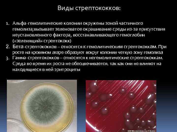 Виды стрептококков: 1. Альфа-гемолитические колонии окружены зоной частичного гемолиза; вызывает зеленоватое окрашивание среды из-за