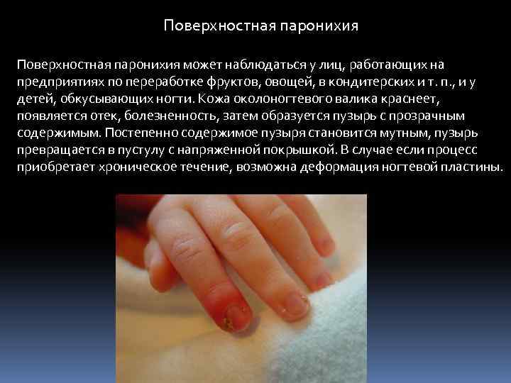 Поверхностная паронихия может наблюдаться у лиц, работающих на предприятиях по переработке фруктов, овощей, в