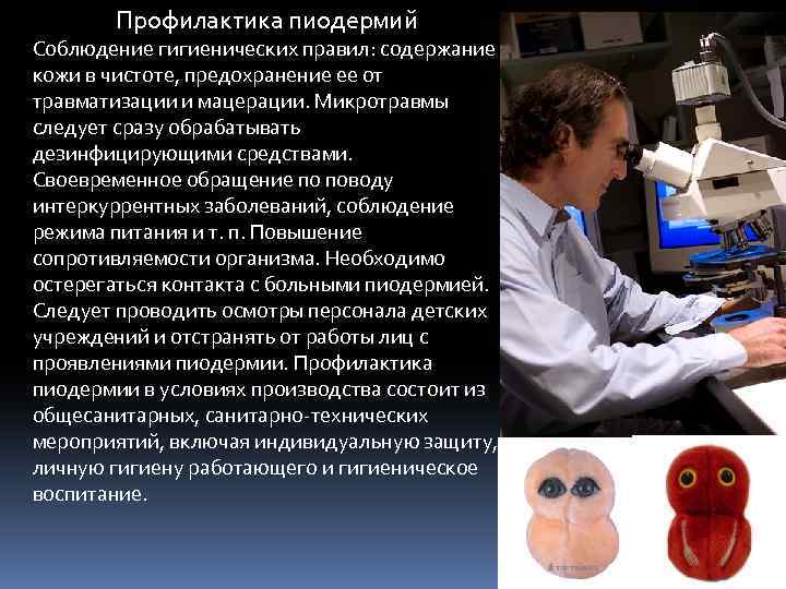 Профилактика пиодермий Соблюдение гигиенических правил: содержание кожи в чистоте, предохранение ее от травматизации и