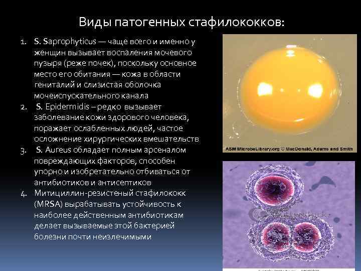 Виды патогенных стафилококков: 1. S. Saprophyticus — чаще всего и именно у женщин вызывает