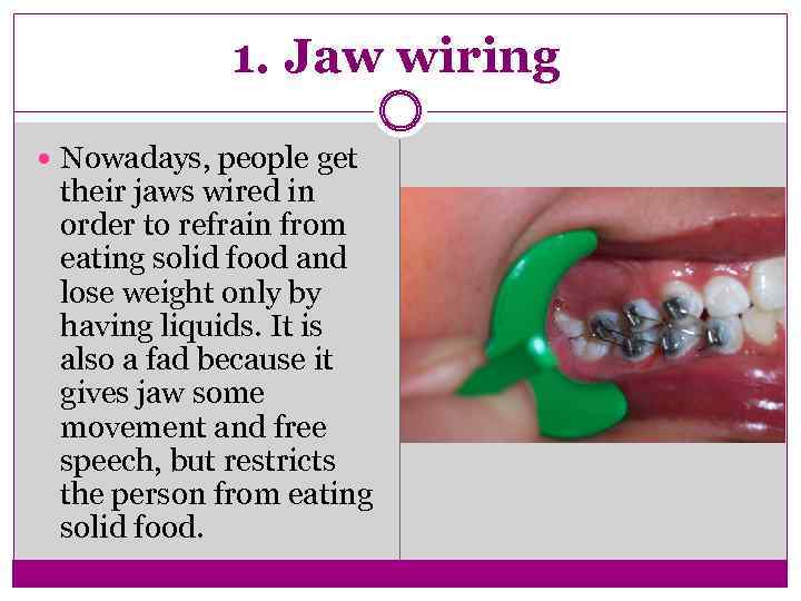 1. Jaw wiring Nowadays, people get their jaws wired in order to refrain from