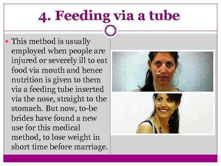 4. Feeding via a tube This method is usually employed when people are injured