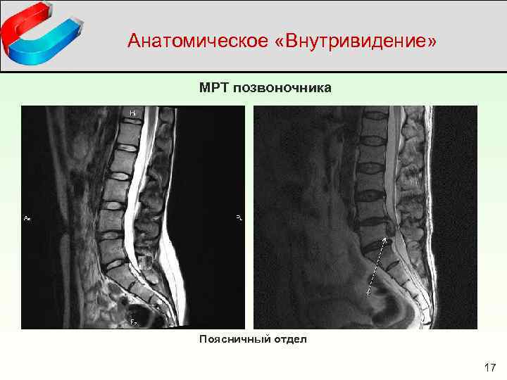 Отделы позвоночника для мрт схема фото и названия