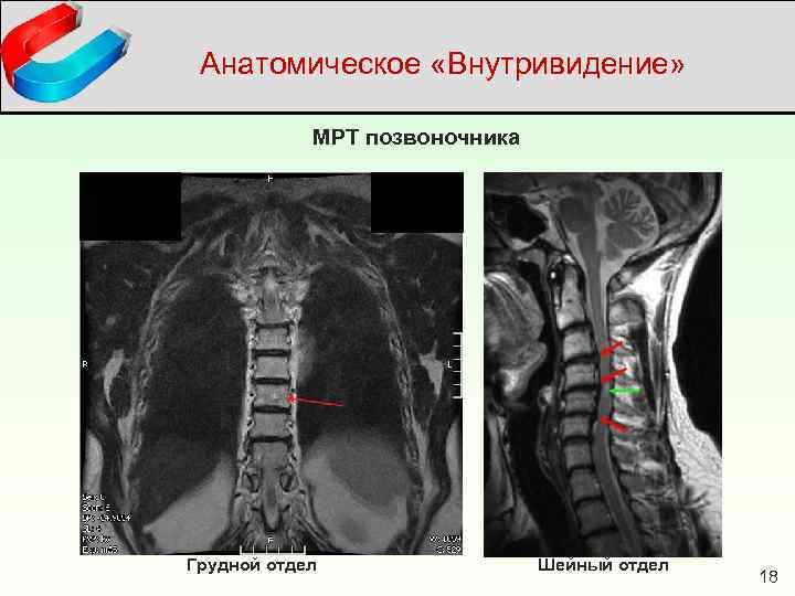 Отделы позвоночника для мрт схема фото и названия и описание