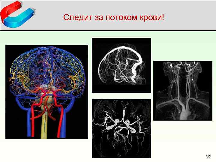 Следит за потоком крови! 22 