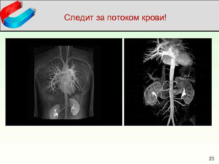 Следит за потоком крови! 23 