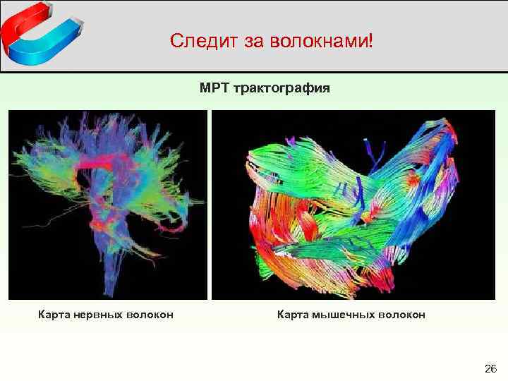 Следит за волокнами! МРТ трактография Карта нервных волокон Карта мышечных волокон 26 