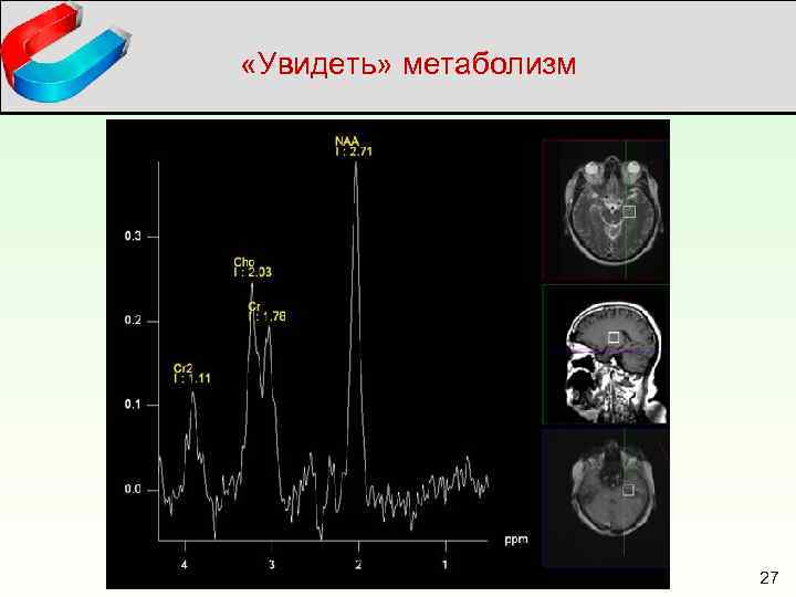  «Увидеть» метаболизм 27 