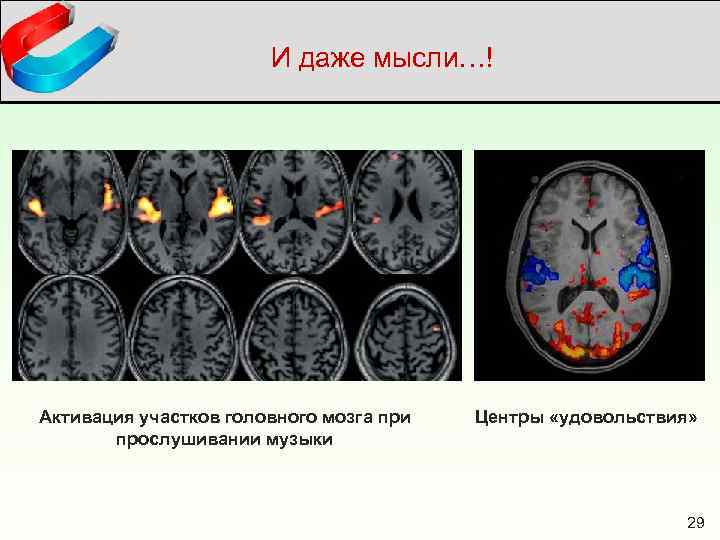 И даже мысли…! Активация участков головного мозга при прослушивании музыки Центры «удовольствия» 29 