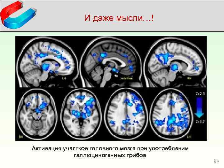 И даже мысли…! Активация участков головного мозга при употреблении галлюциногенных грибов 30 