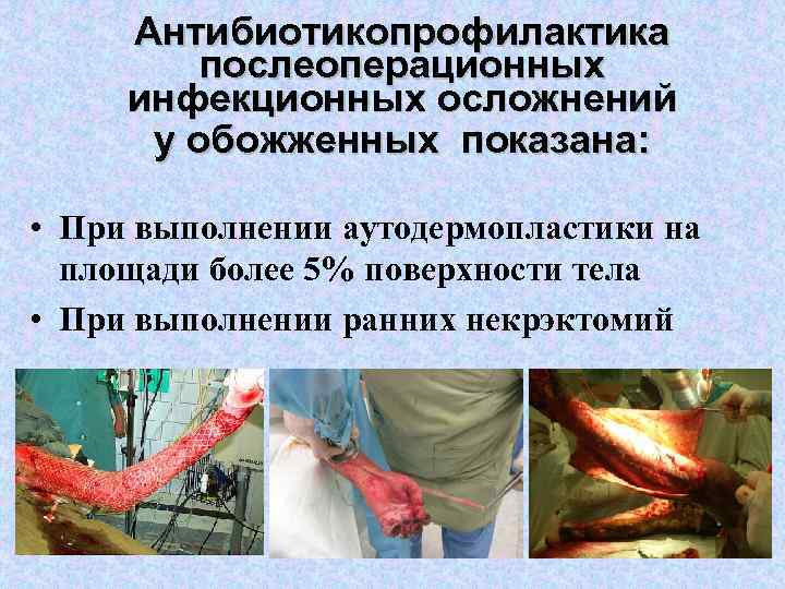 Антибиотикопрофилактика послеоперационных инфекционных осложнений у обожженных показана: • При выполнении аутодермопластики на площади более