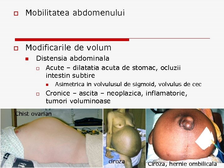 o Mobilitatea abdomenului o Modificarile de volum n Distensia abdominala o Acute – dilatatia