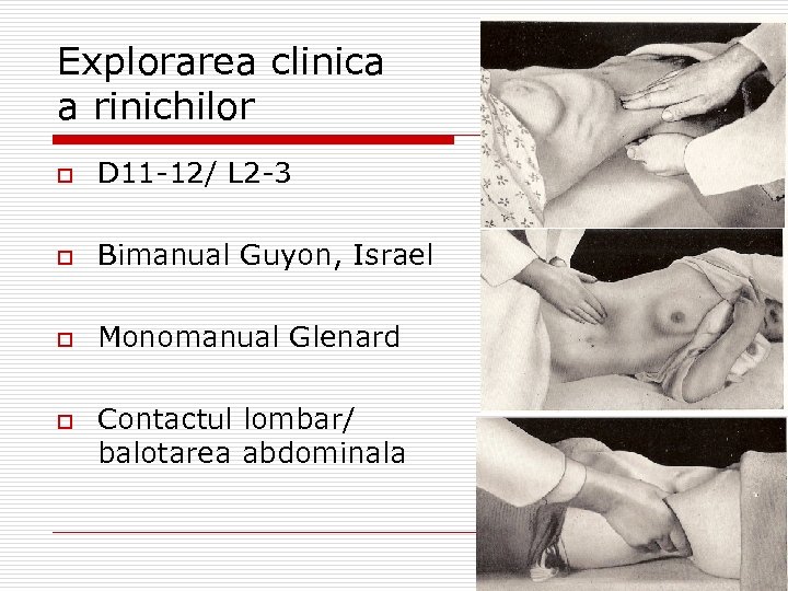 Explorarea clinica a rinichilor o D 11 -12/ L 2 -3 o Bimanual Guyon,