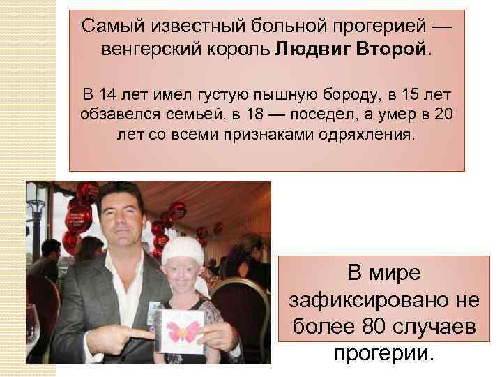 Самый известный больной прогерией — венгерский король Людвиг Второй. В 14 лет имел густую