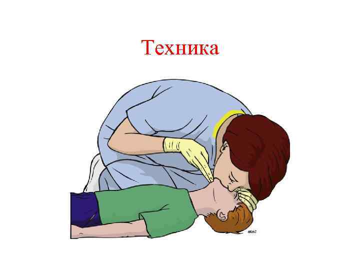 Техника 