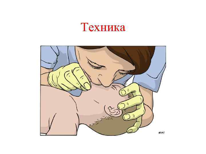 Техника 