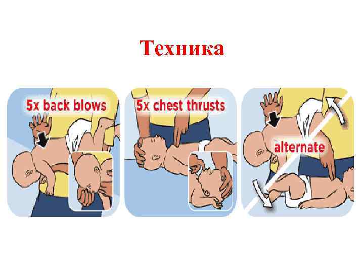 Техника 