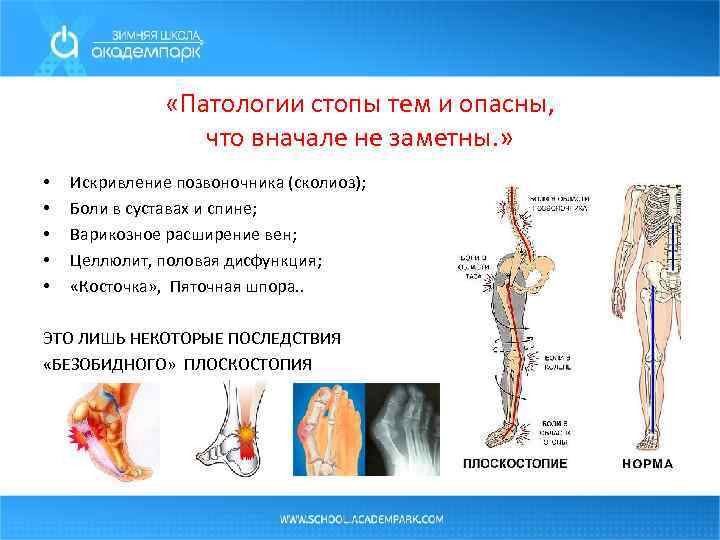  «Патологии стопы тем и опасны, что вначале не заметны. » • • •