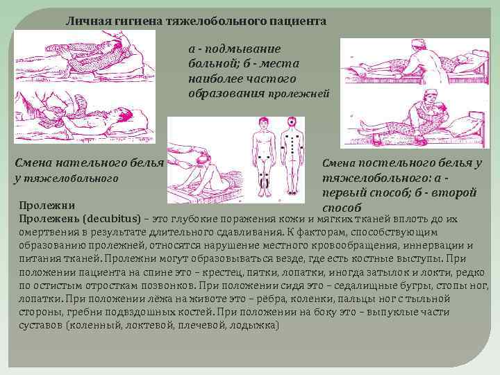 Личная гигиена тяжелобольного пациента а - подмывание больной; б - места наиболее частого образования