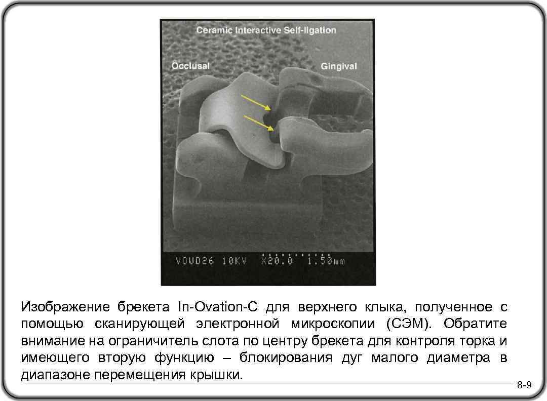 Изображение брекета In-Ovation-C для верхнего клыка, полученное с помощью сканирующей электронной микроскопии (СЭМ). Обратите