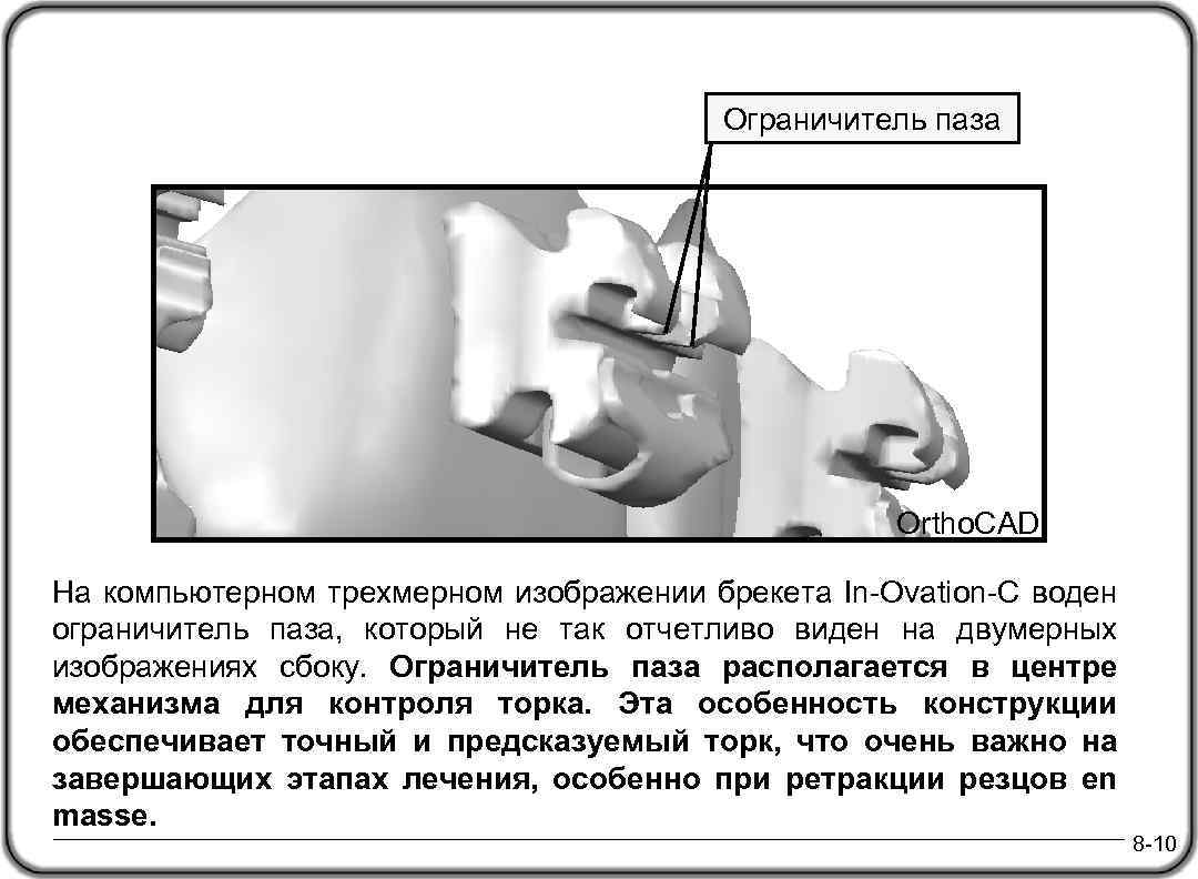 Ограничитель паза Ortho. CAD На компьютерном трехмерном изображении брекета In-Ovation-C воден ограничитель паза, который
