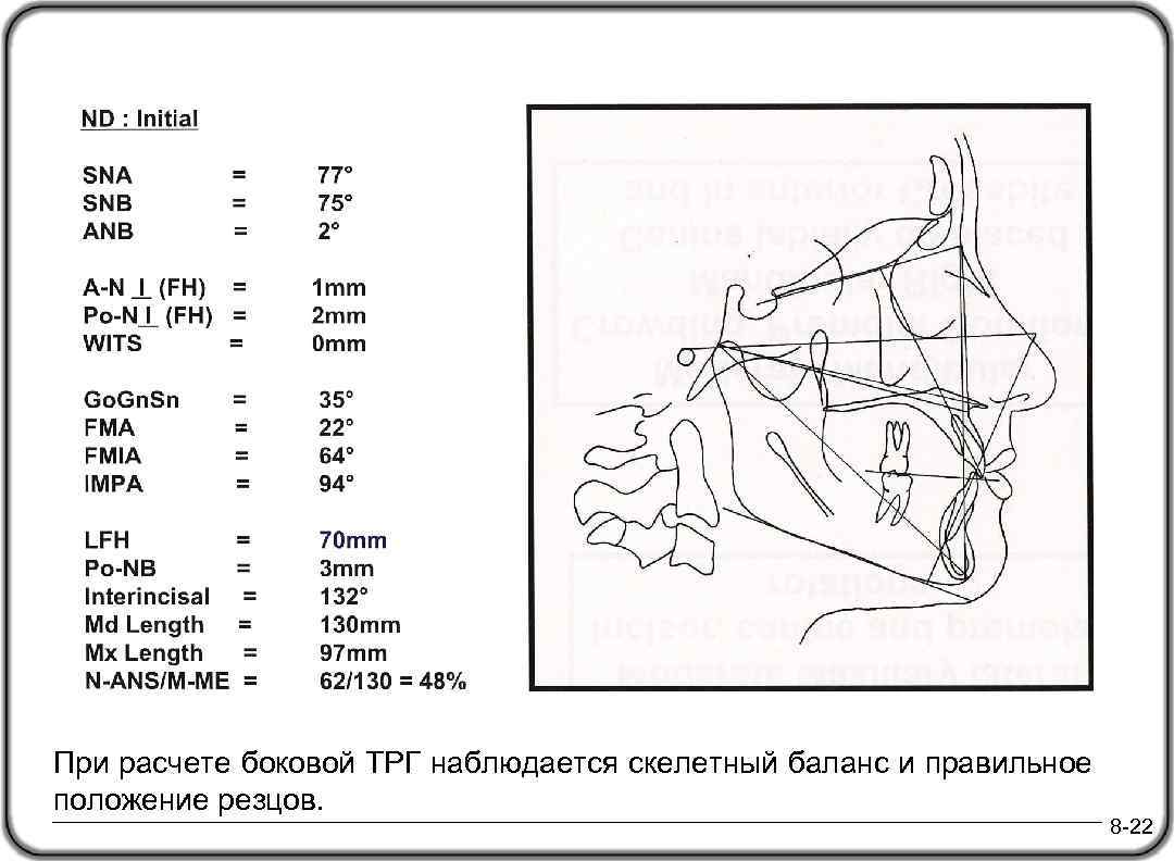 Трг в ортодонтии презентация