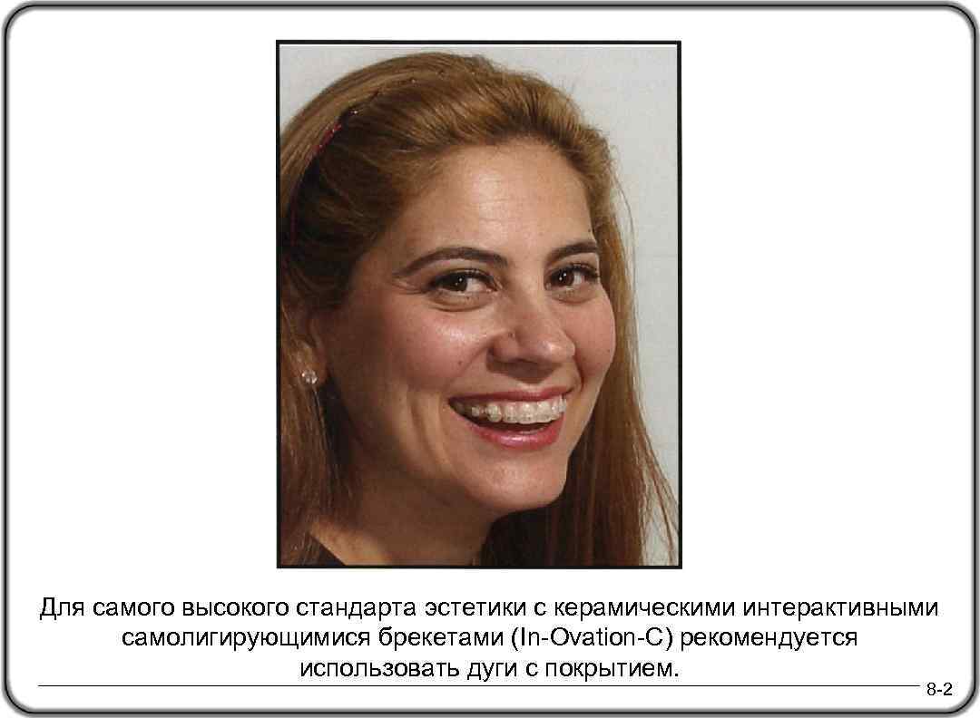 Для самого высокого стандарта эстетики с керамическими интерактивными самолигирующимися брекетами (In-Ovation-C) рекомендуется использовать дуги