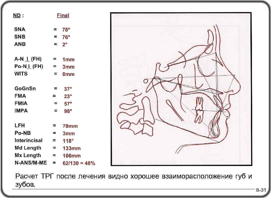 Трг в ортодонтии презентация