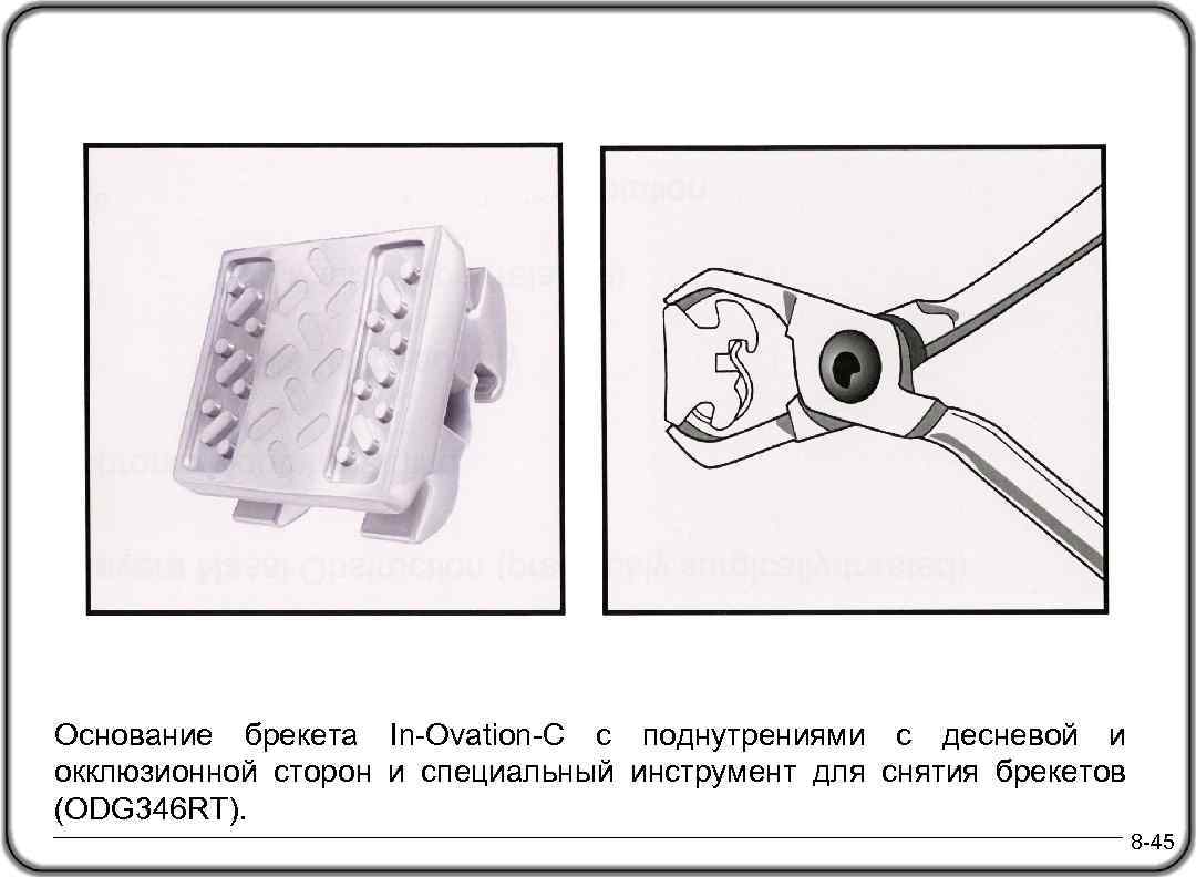 Основание брекета In-Ovation-C с поднутрениями с десневой и окклюзионной сторон и специальный инструмент для