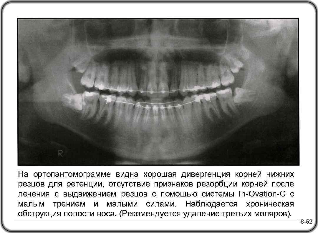 Схема описания оптг