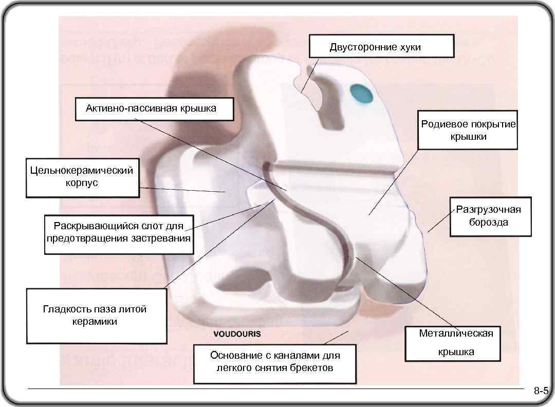 Двусторонние хуки Активно-пассивная крышка Родиевое покрытие крышки Цельнокерамический корпус Разгрузочная борозда Раскрывающийся слот для