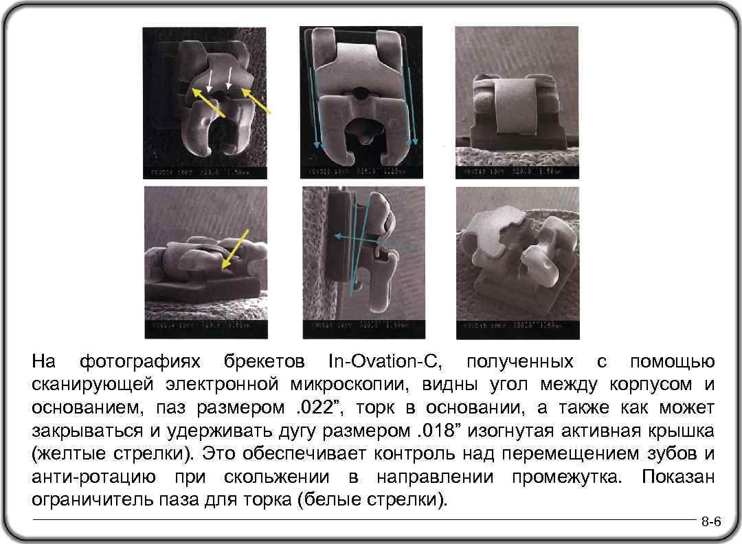  На фотографиях брекетов In-Ovation-C, полученных с помощью сканирующей электронной микроскопии, видны угол между