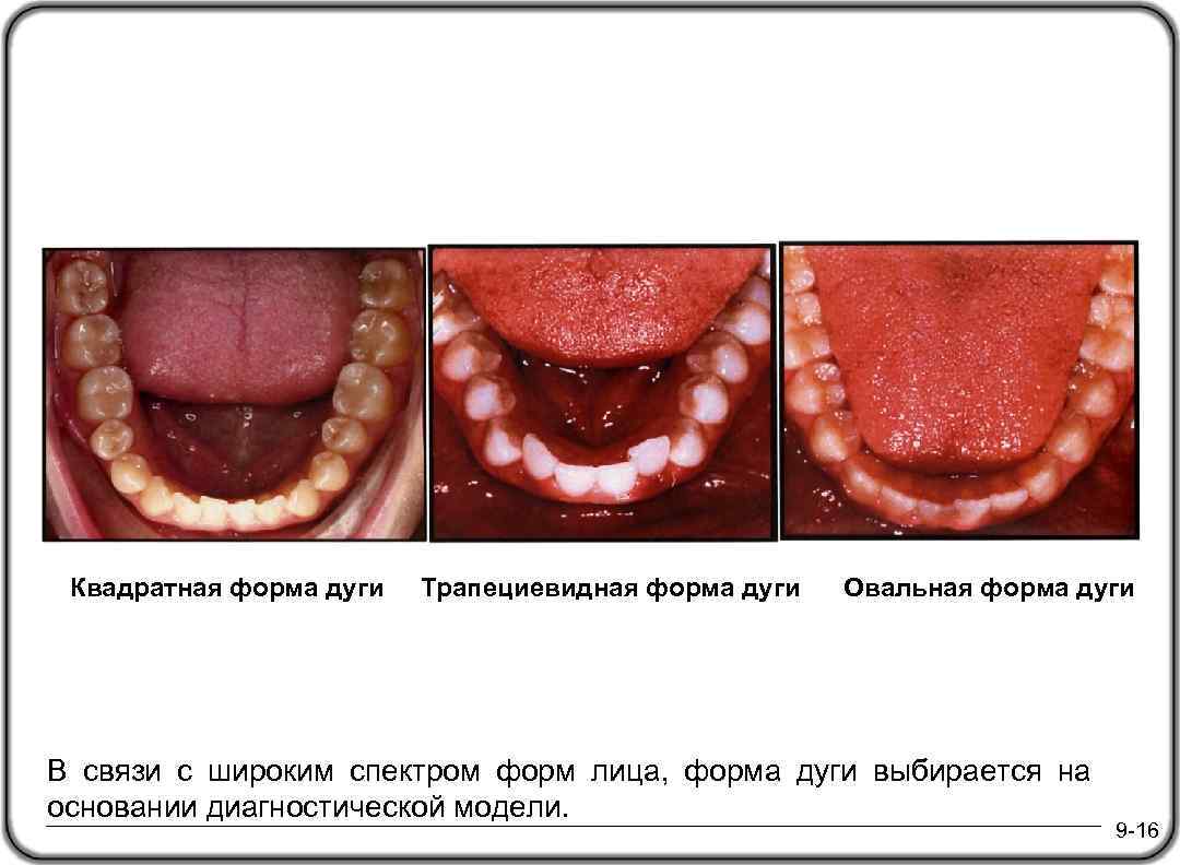 Квадратная форма дуги Трапециевидная форма дуги Овальная форма дуги В связи с широким спектром