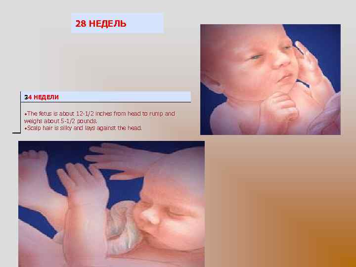 28 НЕДЕЛЬ 34 НЕДЕЛИ The fetus is about 12 -1/2 inches from head to