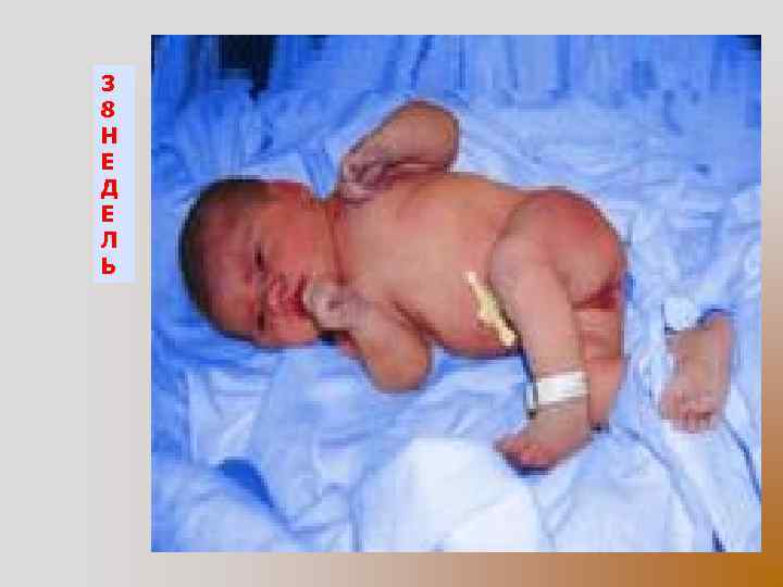 3 8 Н Е Д Е Л Ь 