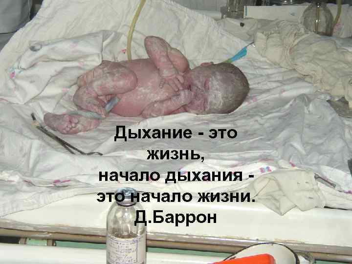 Дыхание - это жизнь, начало дыхания это начало жизни. Д. Баррон 