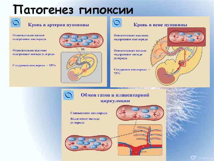 Острая и хроническая гипоксия плода презентация